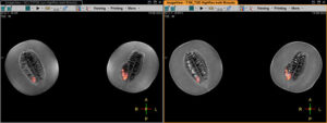 Image of a simultaneous PET MRI scan of melons